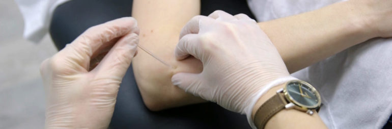 Intra-Muscular Stimulation (IMS)